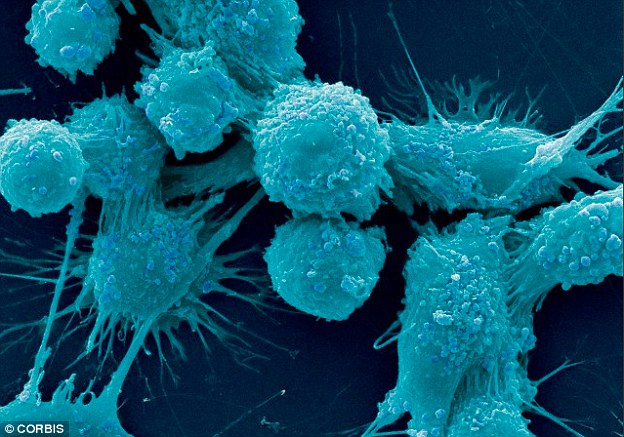 Prostate cancer patients eating ‘western’ diet more likely to die from disease