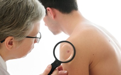 Erectile Dysfunction drugs do not increase risk of melanoma